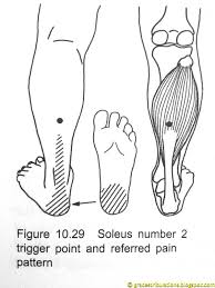 Pin On Trigger Points