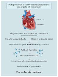 Image result for Cardiac Contusion