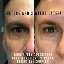 Pin On Eye Cream For 20s