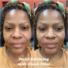 Irene Ware- Nurse Injector