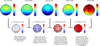 Resting state EEG biomarkers of cognitive decline associated with  Alzheimer's disease and mild cognitive impairment