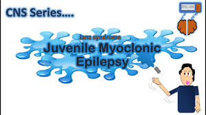 Juvenile Myoclonic Epilepsy Jme Cns Series Ch 4 Youtube