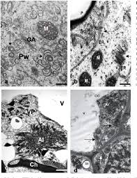 Mitochondria plant cell electron microscope. Figure 3 From Seeing Is Believing The Use Of Light Fluorescent And Transmission Electron Microscopy In The Observation Of Pathological Changes During Different Plant Virus Interactions Semantic Scholar