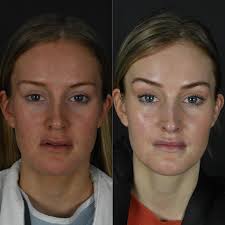 Michael Roskies, MD, MSc, FRCSC