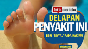 Kondisi ini bisa disebabkan oleh berbagai hal, mulai dari terlalu lama berdiri dengan mengetahui penyebab kaki bengkak, penanganan dapat dilakukan dengan tepat. Kaki Bengkak Waspadai Pertanda Penyakit Ini Youtube