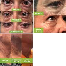 Medspa At New Leaf New Leaf Wellness