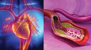 Unlike plaque, which can be removed through proper oral hygiene, tartar is much more difficult to get rid of and usually requires a professional dental cleanup. How To Prevent Arterial Plaque Ruptures Life Extension