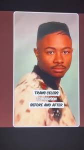 Transformación de Ts Madison: Antes y Después