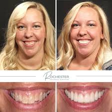 Step into a dental experience that puts your comfort first. At Rochester  Advanced Dentistry, we go beyond the standard of care to provide  personalized, advanced, and comprehensive treatment in a relaxing  environment.