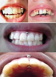 home tattoo spirit piercing piercing mund smiley piercing