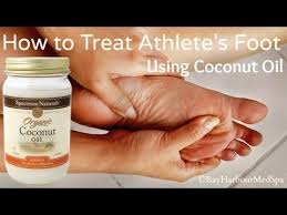 1.tea tree oil with coconut or olive oil. How To Naturally Treat Athlete S Foot Diy Using Coconut Oil Youtube