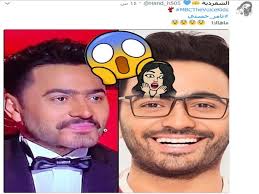 من أجل إجراء تشخيص اقصائي وإجراء تشخيص نهائي للفيروس، يجب الاتصال بأقرب قسم للطوارئ في حالة وجود شكوى تتعلق بالمرض ويجب إجراء الفحوصات المطلوبة من قبل الطبيب. Ù‡Ù„ Ù„Ø§Ø­Ø¸Øª ÙƒÙ… Ø¹Ù…Ù„ÙŠØ© ØªØ¬Ù…ÙŠÙ„ Ø®Ø¶Ø¹ Ù„Ù‡Ø§ ØªØ§Ù…Ø± Ø­Ø³Ù†ÙŠ Ø­ØªÙ‰ ÙŠØ¨Ø¯Ùˆ Ø¨Ù‡Ø°Ø§ Ø§Ù„Ø´ÙƒÙ„ Ø´Ø§Ù‡Ø¯ Ø§Ù„ØµÙˆØ± Ù„ØªÙƒØªØ´Ù