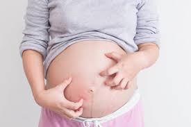 Juckender Bauch In Der Schwangerschaft Bauch De