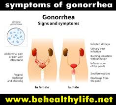 Check spelling or type a new query. Things You Should Know About Gonorrhea Healthgist Net