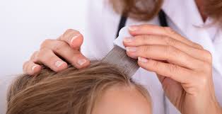 There is some evidence that hair color, when applied to hair that has been infested with lice, will kill active bugs. How To Effectively Use A Nit Comb Safe Sound Health