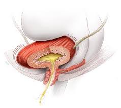 Overactive Bladder - Your Pelvic Floor