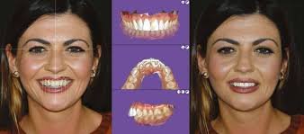 Cosa cambia con la nuova legge?