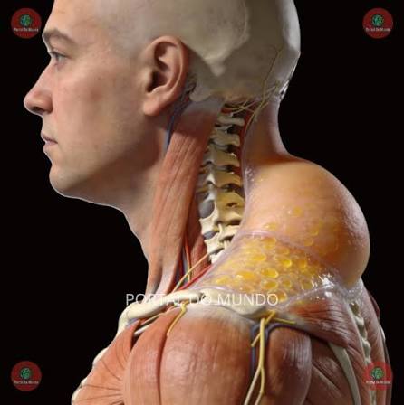 A giba de búfalo é o acúmulo de gordura densa na região de trás do pescoço  e entre os ombros, conhecido na medicina como coxim gorduroso  dorsocervical. Diferente de um simples desvio