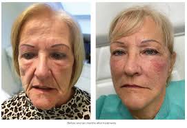 The Aesthetic Awards 2024: Celebrating Excellence in Aesthetics