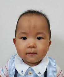 特徴的な顔貌の無いヌーナン症候群（写真あり） | 日々成長。肥大型心筋症っ子と楽しい毎日☆