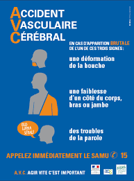 Les Signes De L Avc Ministere Des Solidarites Et De La Sante