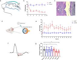 Image result for site:byggahus.se grus till infiltration