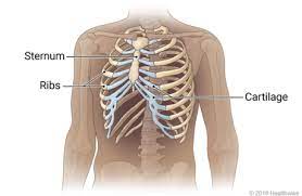 A rib that's bruised or cracked is damaged, but still in its place in the rib cage. Rib Cage Cigna