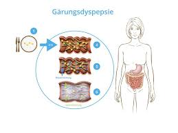 Übelriechender stuhl mit atypischer konsistenz und farbe. Garungsdyspepsie Ursache Symptome Therapie Und Ernahrung Cara Care
