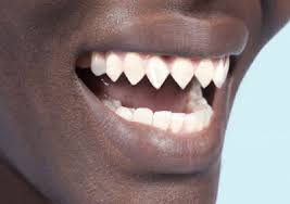 The Fascinating Tradition of Teeth Sharpening in 18th Century Africa: History and Cultural Significance | Blog Face2face Africa