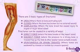 Fractures Dislocations Sprains Strains