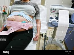 Image result for Non-Stress Test