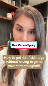 How to get rid of skin tags?😱😱😱recommend sefudun bee venom  spray👍👍👍#skin #skincare #skintags #fyp #bee #beevenom #treament #repair  #tiktokmademebuyit #skinrepair #tags #removal #glow #smooth #beauty ...