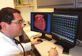 Feinberg Endowed Chair in Stroke Research