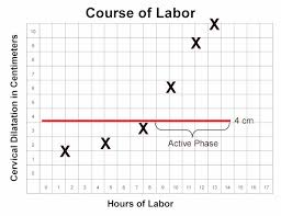 labor