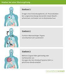 Sepsis happens when an infection spreads and causes your body to react strongly to germs. Blutvergiftung Risikogruppen Symptome Behandlung Vorbeugung