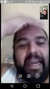 Hey Travis Poiriertravis you need this guy out there that way you can grow  the hair back