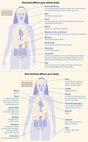 anorexia vs bulimia difference and comparison diffen