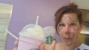 Fundraiser by Aurora Knox : Motorcycle accident Recovery for Alexandria