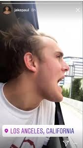 Check spelling or type a new query. If You Think Ksi S Hairline Is Bad Think Again Ksi