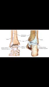 Image result for Ankle External Rotation Test