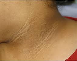 Image result for Thesium nigricans