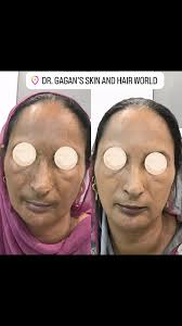 Dr. Gagandeep Kaur MD_SKIN (@drgagandeepkaurmd) · Instagram 照片和视频