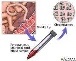 Two types of banks have emerged for the collection and storage of umbilical cord blood: Percutaneous Umbilical Cord Blood Sampling Series Results Medlineplus Medical Encyclopedia