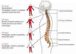 Bone loss because of age can make your back weak, too, and you might get a break that happens slowly over time. Common Symptoms Of Spinal Cord Injury Spinal Cord Injury Happens When There Is Any Injury To The S Spinal Cord Injury Nursing Spinal Cord Injury Spinal Injury