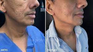 𝐃𝐑 𝐍𝐎𝐑𝐀 𝐒𝐓𝐀𝐍𝐅𝐎𝐑𝐃 𝐏𝐥𝐚𝐬𝐭𝐢𝐜 S𝐮𝐫𝐠𝐞𝐨𝐧  (@drnorastanford) • Instagram photos and videos