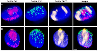 Maybe you would like to learn more about one of these? Ijms Free Full Text Nuclear Disposition Of Alien Chromosome Introgressions Into Wheat And Rye Using 3d Fish Html