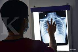 We did not find results for: Cara Mengatasi Kekurangan Oksigen Dalam Darah