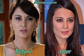 Minissha Lamba Plastic Surgery Before And After Pictures Her other notable films include honeymoon travels pvt. minissha lamba plastic surgery before