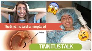 The eardrum, also called the tympanic membrane, is the thin tissue separating the ear canal from the middle ear. The Time My Eardrum Ruptured And I Got Tinnitus Storytime Story Surgery Recovery Youtube