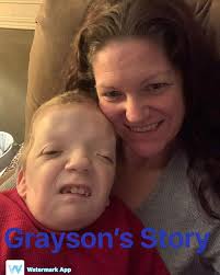 Grayson's Story